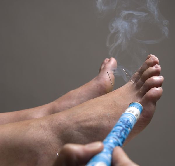 Moxibustion Carolyn Mayo, DACM, LAc